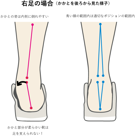 靴による足のアライメントのイメージ